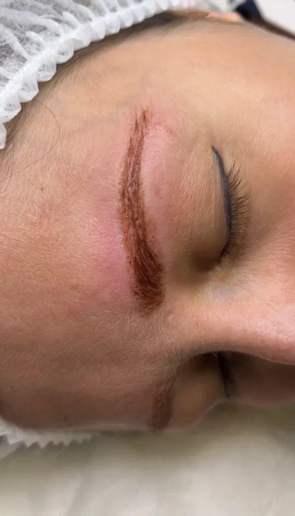 remove eyebrow tattoo