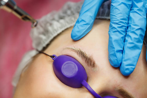 remove permanent eyebrow tattoo